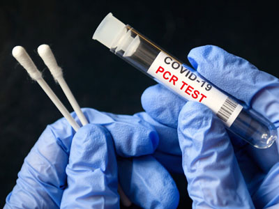 Las Obras Sociales y Prepagas deben cubrir los tests diagnósticos (PCR y/u otros)